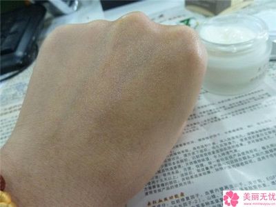 福州市凹陷疤痕激光手術的醫院哪家機構好-凹陷疤痕激光手術價格究竟是多少